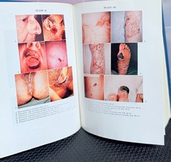 Cancer of The Skin VOL 1 : Biology-Diagnosis-Management by Andrade, Gumport