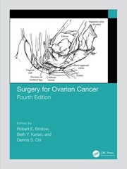 Surgery for Ovarian Cancer –