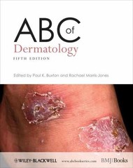 ABC of Dermatology – Paperback, by Buxton Paul K.; Morris-Jones – Very Good