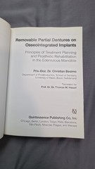 Removable Partial Dentures on Osseointegrated Implants by Christian Besimo