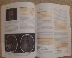 ACP MKSAP 19 Neurology Text Book