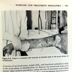 Vintage Comprehensive Rehabilitation of Burns Book Hardcover RML 1984