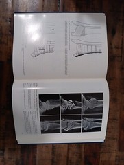 Internal Fixation of Small Fractures 3rd Edition U. Heim & KM Pfeiffer AO-ASIF