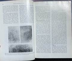 Cancer of The Skin VOL 1 : Biology-Diagnosis-Management by Andrade, Gumport