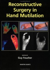 Reconstructive Surgery in Hand Mutilation