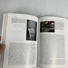 Prevention and Management of Common Fracture Complications 2012 HC