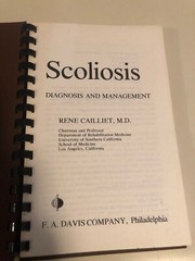 Scoliosis Diagnosis and Management Rene Cailliet MD 1983 Spiral Bound