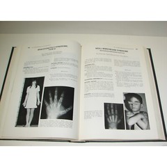 Smith’s Recognizable Patterns of Human Malformations medical book by Jones M.D.