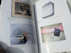 Interventional Pain Control in Cancer Pain Management Oxford Hester Sykes PeatHC