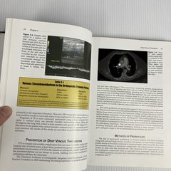 Prevention and Management of Common Fracture Complications 2012 HC