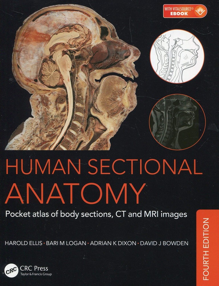 Human Sectional Anatomy: Pocket atlas of body sections, CT and MRI images, F…