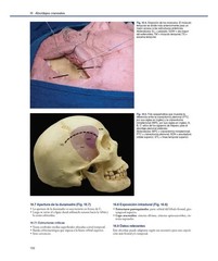 Cirugía endoscópica lateral de la base del cráneo. Principios, anatomía