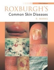Roxburgh’s Common Skin Diseases, 17Ed (Medicine) by Marks, Ronald Paperback The