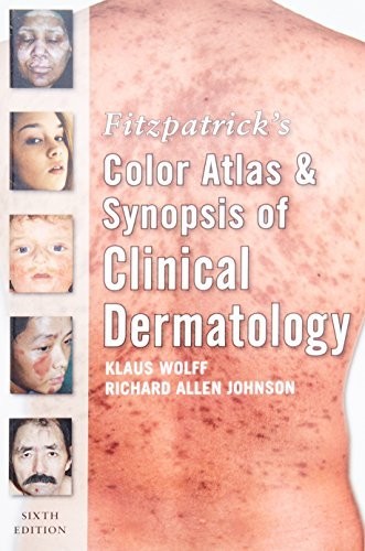 Fitzpatrick’s Color Atlas and Synopsis o… by Wolff, Klaus Paperback / softback