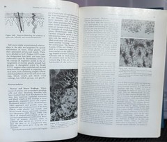 Cancer of The Skin VOL 1 : Biology-Diagnosis-Management by Andrade, Gumport