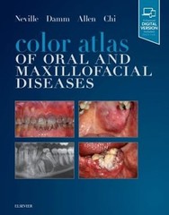Color Atlas of Oral and Maxillofacial Diseases by Dds Neville, Brad W: Used