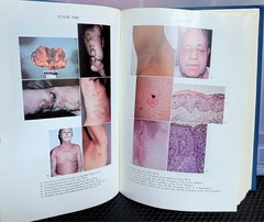 Cancer of The Skin VOL 1 : Biology-Diagnosis-Management by Andrade, Gumport
