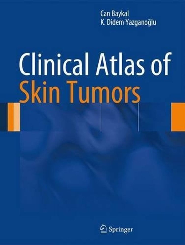 Clinical Atlas of Skin Tumors by Can Baykal (English) Hardcover Book