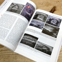 Fundamentals of Musculoskeletal Ultrasound (Fundamentals of Radiology) 3rd Ed