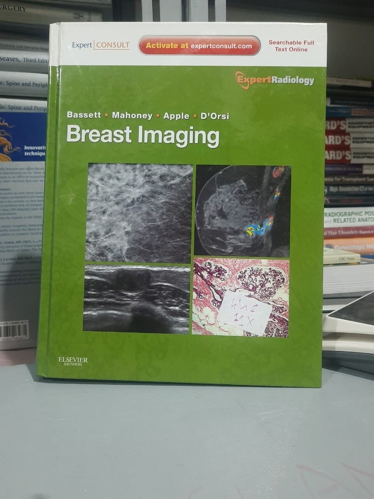 Breast Imaging: Expert Radiology Series