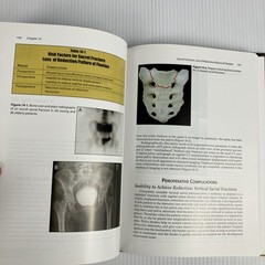 Prevention and Management of Common Fracture Complications 2012 HC