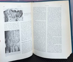 Cancer of The Skin VOL 1 : Biology-Diagnosis-Management by Andrade, Gumport
