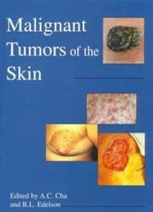 Malignant Tumors of the Skin, , 9780340740866