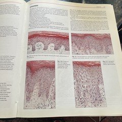 Pathology Of The Skin with clinical correlations by McKee 2nd Edition