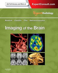 IMAGING OF THE BRAIN: EXPERT RADIOLOGY SERIES BY James G. Smirniotopoulos Md