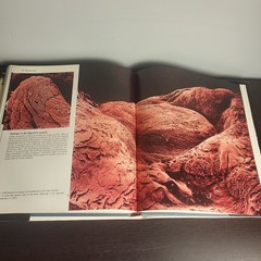 The Body Victorious THE ILLUSTRATED STORY OF OUR IMMUNE By Lennart Nilsson, Used