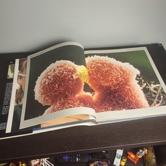 The Body Victorious THE ILLUSTRATED STORY OF OUR IMMUNE By Lennart Nilsson, Used