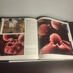 The Body Victorious THE ILLUSTRATED STORY OF OUR IMMUNE By Lennart Nilsson, Used