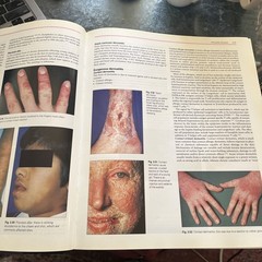 Pathology Of The Skin with clinical correlations by McKee 2nd Edition