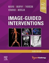 Image-Guided Interventions: Expert Radiology Series by Matthew A. Mauro (English