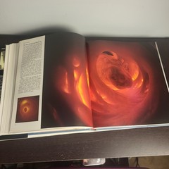 The Body Victorious THE ILLUSTRATED STORY OF OUR IMMUNE By Lennart Nilsson, Used