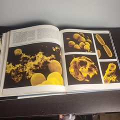 The Body Victorious THE ILLUSTRATED STORY OF OUR IMMUNE By Lennart Nilsson, Used