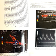 Vintage Technologies in Vascular Surgery Book Hardcover James S. T. Yao 1992