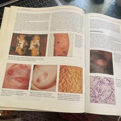 Pathology Of The Skin with clinical correlations by McKee 2nd Edition