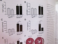 Blood Sickle Cell Disease Compendium 2016 American Society of Hematology PB