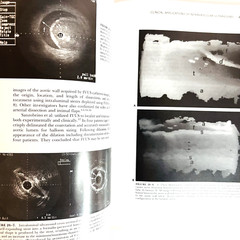 Vintage Technologies in Vascular Surgery Book Hardcover James S. T. Yao 1992