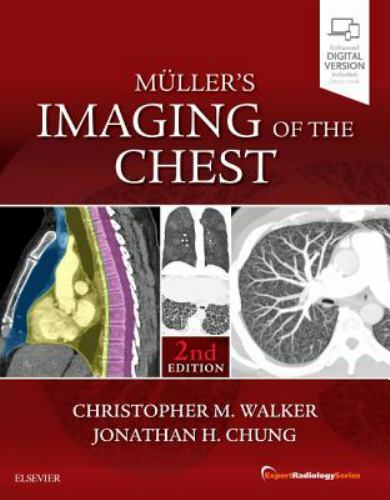 Muller’s Imaging of the Chest, Hardcover by Walker, Christopher M., M.D. (EDT…