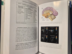 Neurofeedback in Treatment of Developmental Trauma: Fisher LN/HC (see photos:)