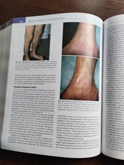 McCance & Huether’s Pathophysiology 9th Edition, Julia L. Rogers